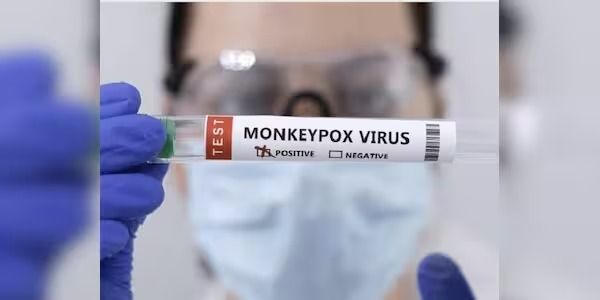 مقام‌های صحی پاکستان از شناسایی یک مورد تازه ام‌پاکس خبر دادند