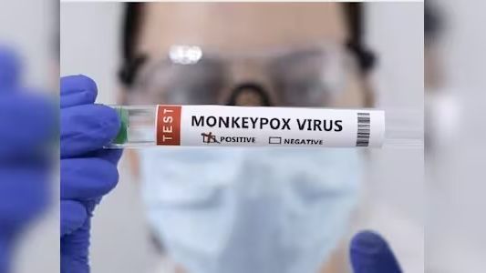 مقامهای صحی پاکستان از شناسایی یک مورد تازه امپاکس خبر دادند