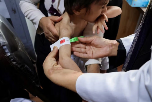 يونيسف: سوء التغذية الحاد يرفع خطر وفاة الأطفال الأفغان حتى 12 ضعفاً