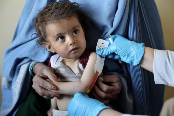 الأمم المتحدة: نحو 200 ألف طفل أفغاني إضافي سيواجهون سوء تغذية حاد