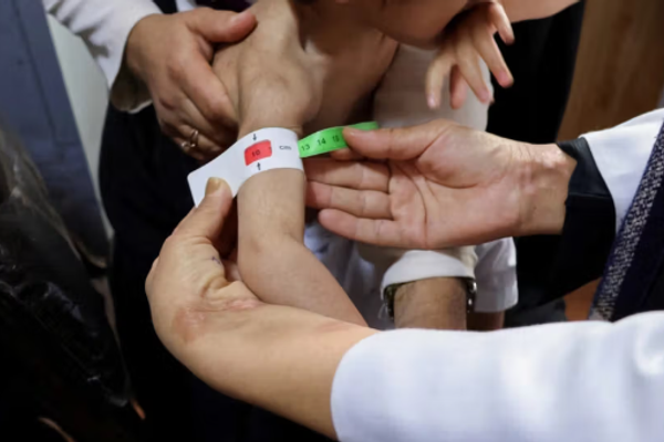 برنامج الأغذية العالمي في أفغانستان: حياة 4 ملايين طفل في خطر بسبب سوء التغذية