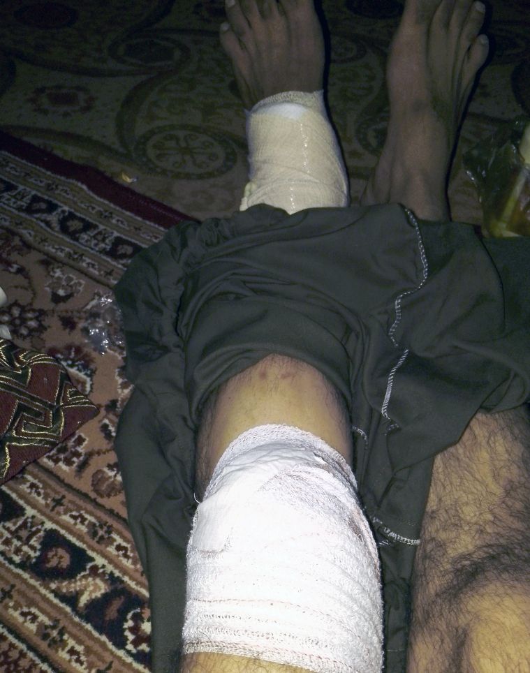 طالبانو د یو بې ګناه زنداني پښه ماته کړې او نوموړی له طالبانو د لیدلي زیان تاوان غواړي