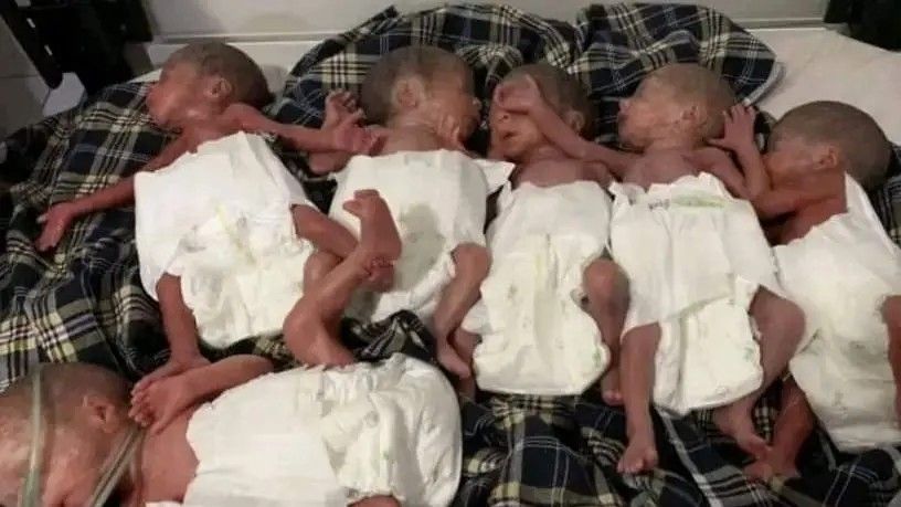 مادری در جوزجان شش فرزند به‌دنیا آورد 