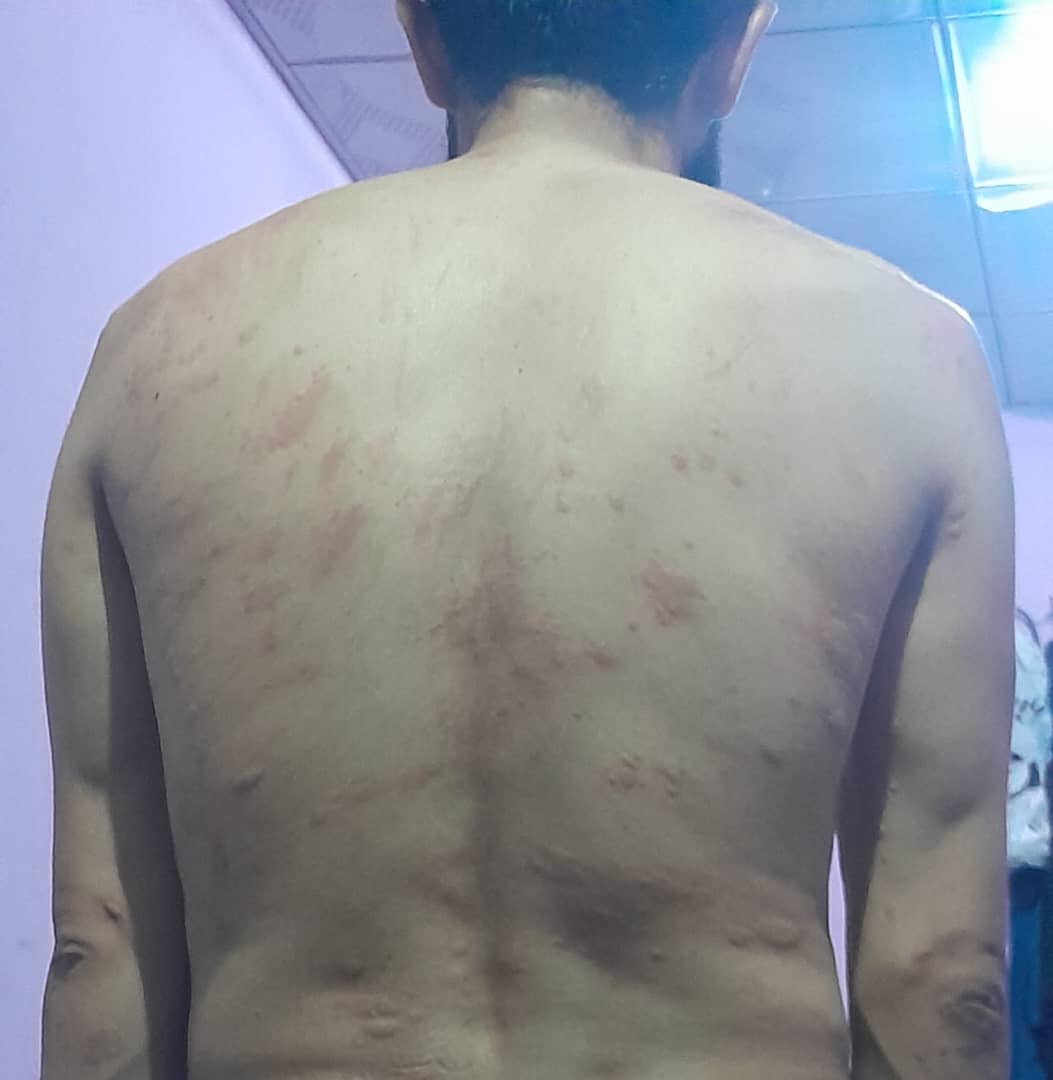 شکنجه یک مهاجر بازگشته از ایران به دست طالبان