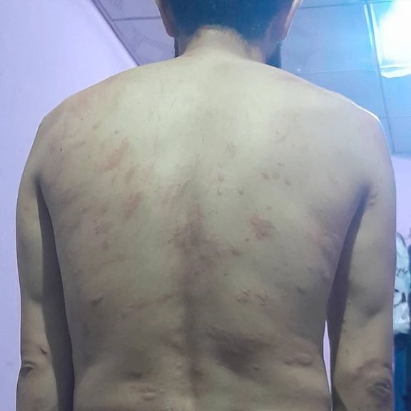 شکنجه یک مهاجر بازگشته از ایران به دست طالبان