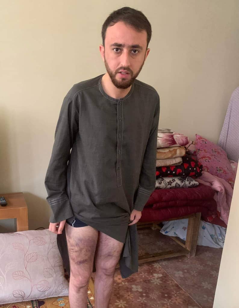 طالبان در ولایت تخار یک خبرنگار محلی را بازداشت و پس از شکنجه آزاد کردند