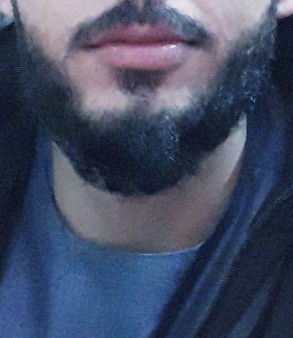 یک معلم: برای خشنودی طالبان ریش گذاشتم اما آن‌ها مرا به اتهام عضویت در داعش لت و کوب کردند