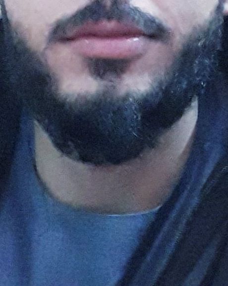 یک معلم: برای خشنودی طالبان ریش گذاشتم اما آنها مرا به اتهام عضویت در داعش لت و کوب کردند