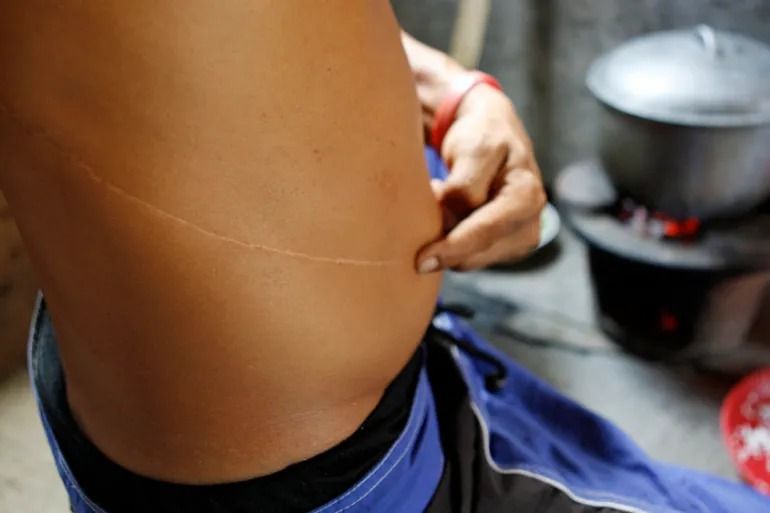 وزارت امر به‌معروف طالبان فروش اعضای بدن انسان را ممنوع کرد