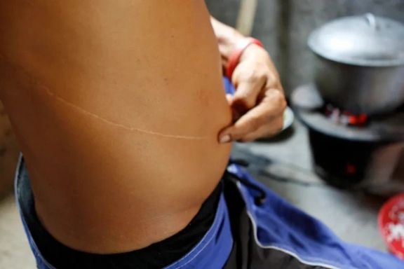 وزارت امر بهمعروف طالبان فروش اعضای بدن انسان را ممنوع کرد