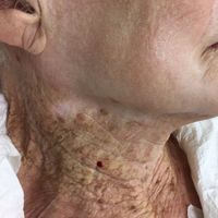 هغه عام عادت چې ځوانان له وخته مخکې زړوي