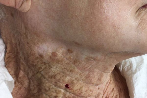 هغه عام عادت چې ځوانان له وخته مخکې زړوي