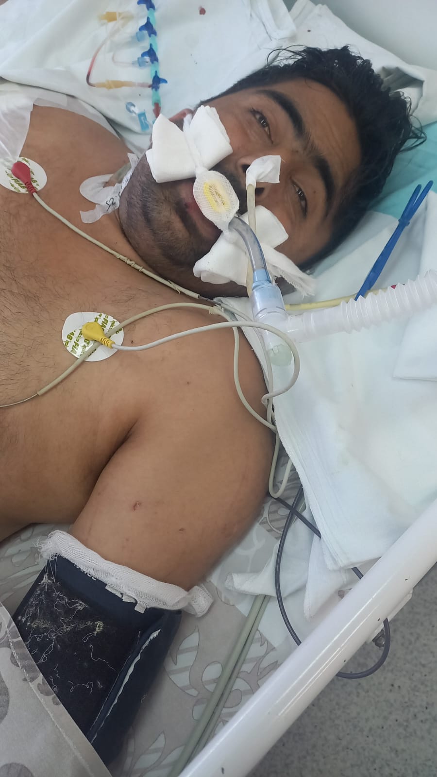 نواب زوی تر درملنې لاندې