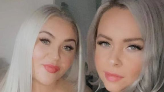 یوه بریتانوۍ ښځه د ترکیې د ښکلا جراحۍ له عوارضو مړه شوه