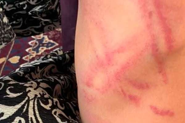 «لتوکوب شدید» یک کودک یتیم در مسجدی در بدخشان