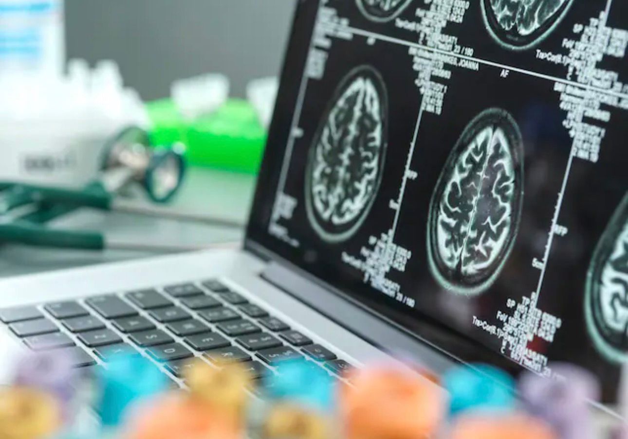 نوې څېړنه؛ د الزایمر د تشخیص لپاره د وینې معاینات څه وایي؟