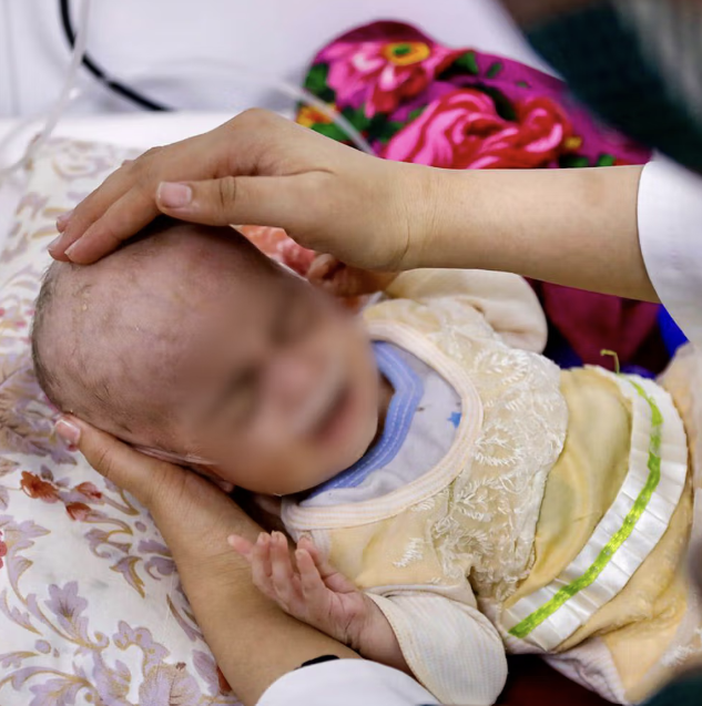 مستشفى ميرويس في قندهار يُضطر بسبب نقص الإمكانات إلى وضع ثلاثة أطفال في سرير واحد