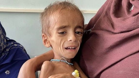 یونېسف: میلیونونه افغان ماشومان له خاموش کړاو او وژونکې لوږې سره مخ دي