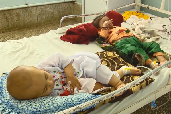 کندهار کې د خوارځواکۍ زیاتوالی؛ روان کال یوازې میرویس روغتون ته ۴زره ماشومان وړل شوي