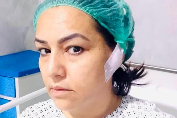 Lost Hearing In One Ear Due To Torture In Taliban’s Prison, Claims Women's Rights Activist