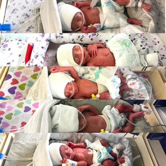 یوې افغانې مور د کابل په اېمرجنسي روغتون کې پنځه ماشومان زېږولي