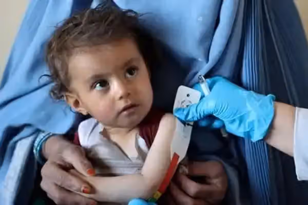 یونېسف: په افغانستان کې نږدې یو مېلیون ماشومان په سختې خوارځواکۍ اخته دي