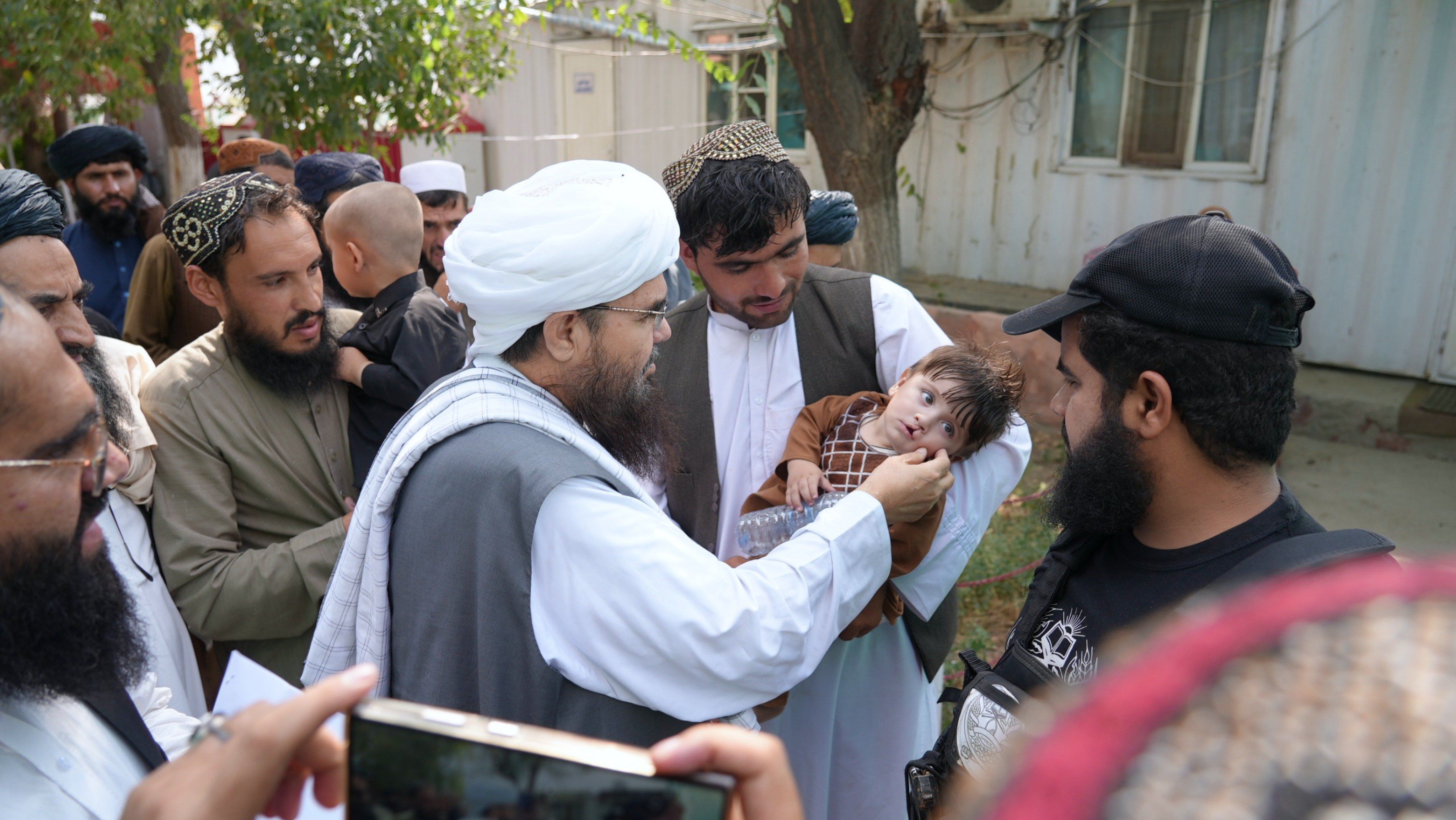 د بنګله‌دېش له لوري کابل کې د شونډو او تالو چاود لرونکو  ۱۲۰ ماشومانو وړیا درملنه پیل شوه
