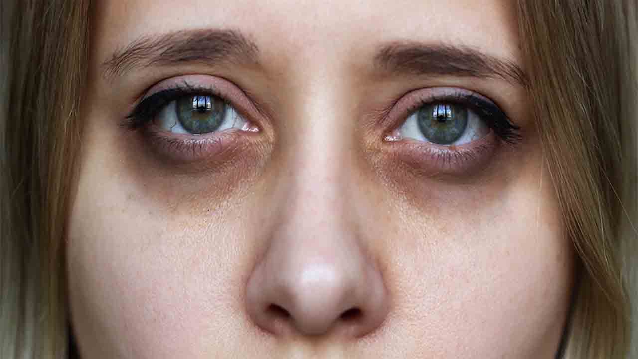 ژوند او روغتیا؛ ولې مو سترګې تورې حلقې وهي؟