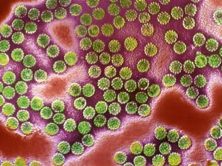 نتیجه یک تحقیق: تقریبا از هر سه مرد در جهان یک نفر به ویروس عفونت مقاربتی آلوده است