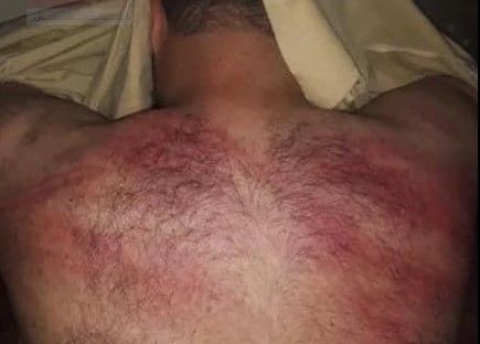 مهاجران افغان می‌گویند پولیس ایران به بازداشت و شکنجه افغان‌های دارای ویزا ادامه داده است