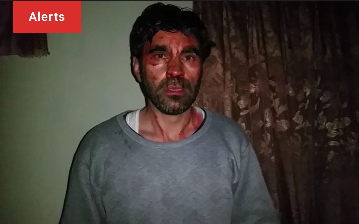 کمیته حفاظت از خبرنگاران: طالبان حمله به مدیر مسئول سابق تلویزیون خاور را بررسی کند
