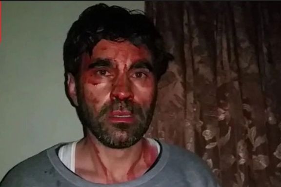 کمیته حفاظت از خبرنگاران: طالبان حمله به مدیر مسئول سابق تلویزیون خاور را بررسی کند