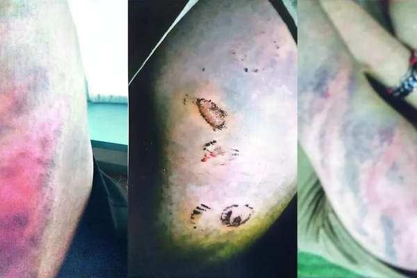 گزارش تازه از تجاوز گروهی افراد طالبان به زن عضو ارتش سابق