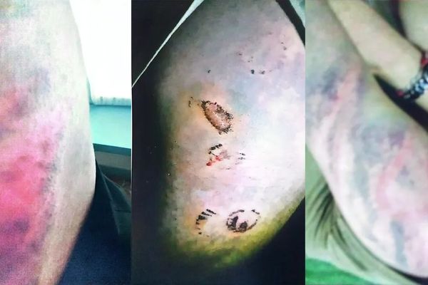 Former Afghan Army Officer Alleges Gang Rape By Taliban In Kabul Detention