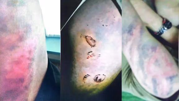 گزارش تازه از تجاوز گروهی افراد طالبان به زن عضو ارتش سابق