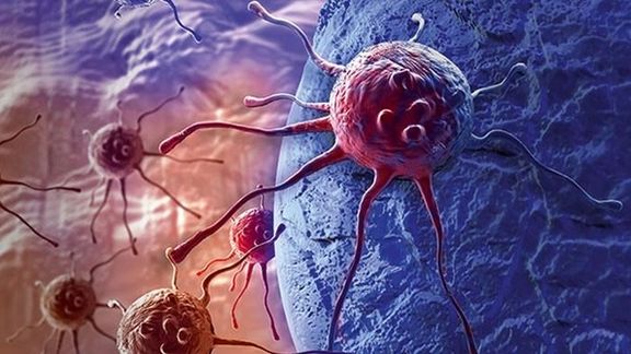 زموږ کوم عادتونه موږ له سرطانونو ژغورلی شي؟