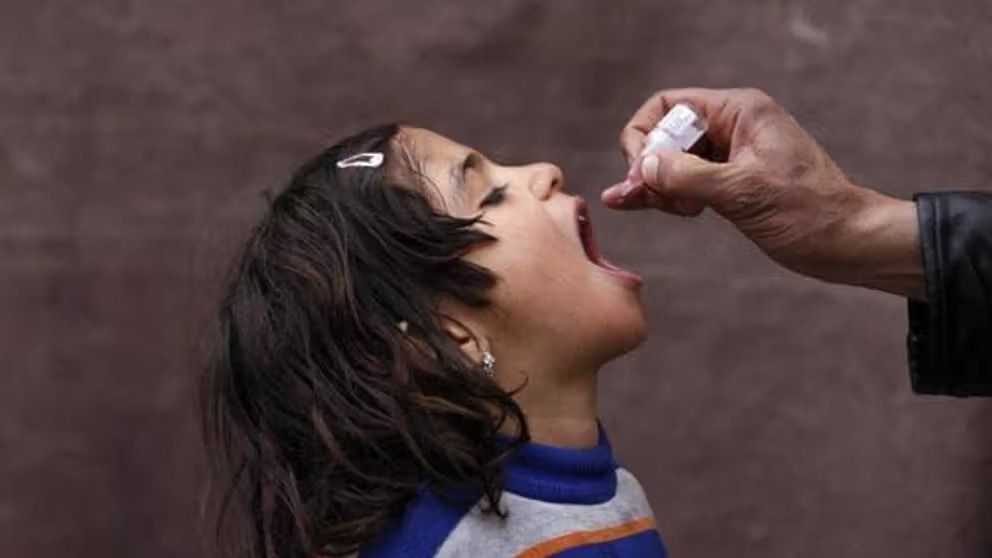 نخستین مورد فلج اطفال سال ۲۰۲۵ در بادغیس شناسایی شد