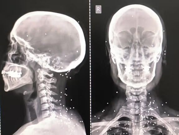 گزارش گاردین از شلیک عمدی به اعضای حیاتی بدن برای سرکوب معترضان در ایران