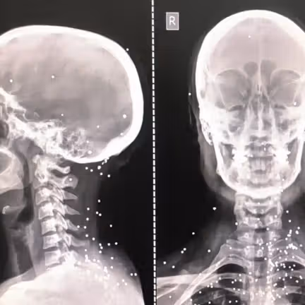 گزارش گاردین از شلیک عمدی به اعضای حیاتی بدن برای سرکوب معترضان در ایران