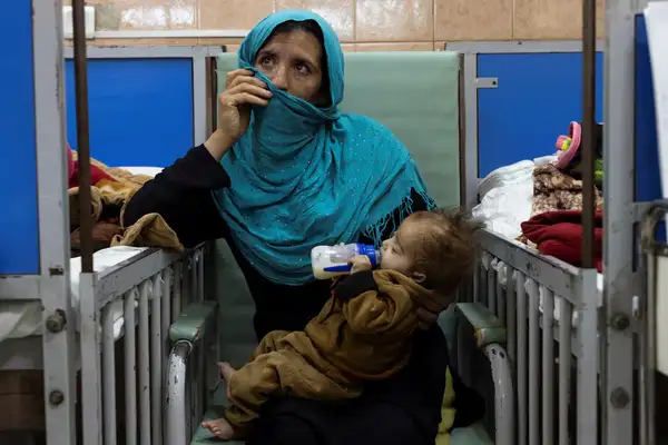 بیش از نیم میلیون کودک در افغانستان به علت لاغری شدید بستری شدهاند