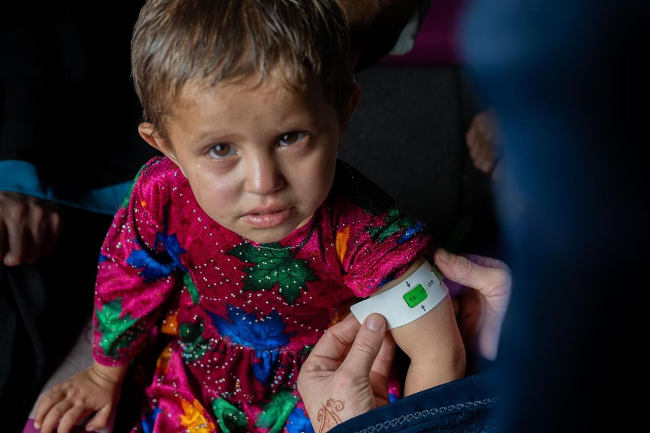 یونېسف: د خوارځواکۍ د پېژندلو لپاره مو د څه باندې یو میلیون افغان ماشومانو معاینه کړې