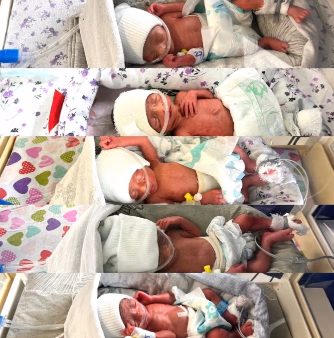 یک مادر در کابل پنجگانه به دنیا آورد