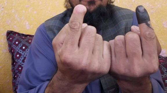 طالبان در ۲۰۱۴ انگشت یک مرد را بهدلیل شرکت در انتخابات قطع کرد