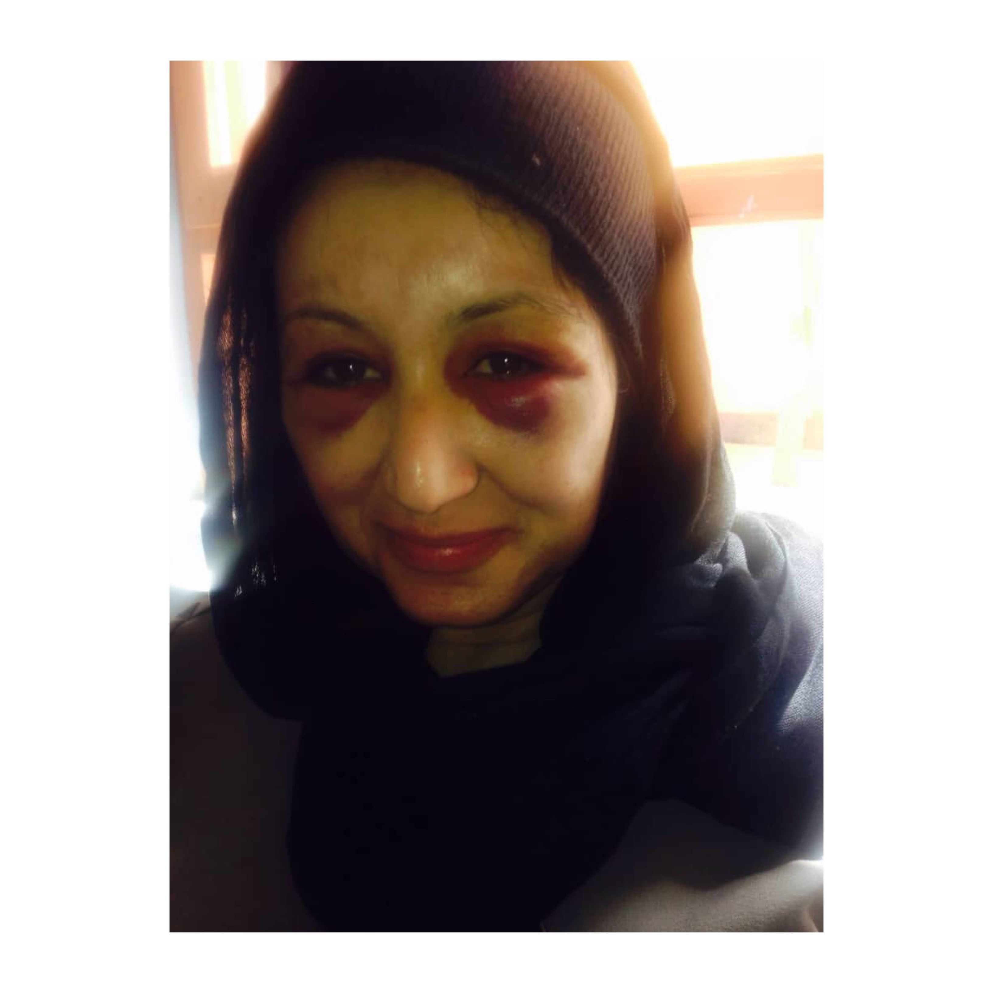 افشاگری زنان از زندان طالبان؛ دگروال امنیت ملی می‌گوید در زندان طالبان شدیدا شکنجه شده است