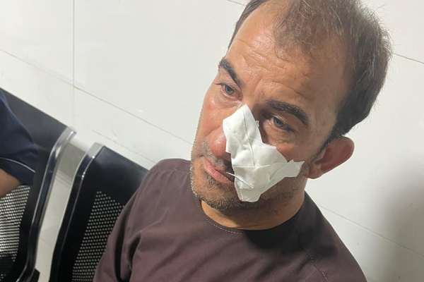 Media Worker Injured In Unknown Individuals’ Attack In Balkh
