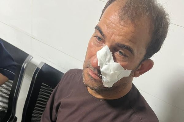 Media Worker Injured In Unknown Individuals’ Attack In Balkh