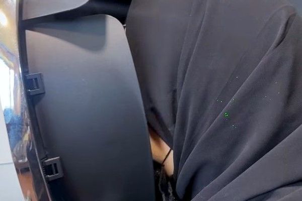 بوتاکس و جراحی زیبایی در افغانستان 'رونق' گرفته است
