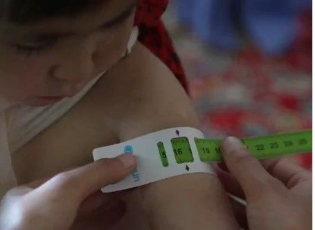 '۳۰ هزار' کارمند صحی تحت حمایت یونیسف در افغانستان کار می‌کنند