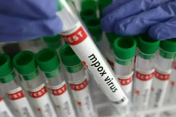 د سند په خیرپور ولسوالۍ کې پر بیزو تڼاکې ويروس اخته څلور ماشومان مړه شوي