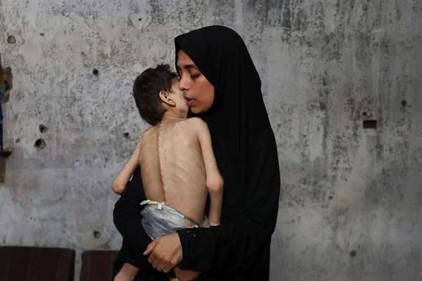 سازمان ملل: ساکنان غزه به «اجساد متحرک» بدل شدهاند